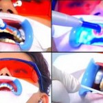 Các phương pháp tẩy trắng hiệu quả