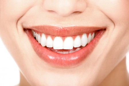 Niềng răng khểnh có phải bắt buộc nhổ răng không? 