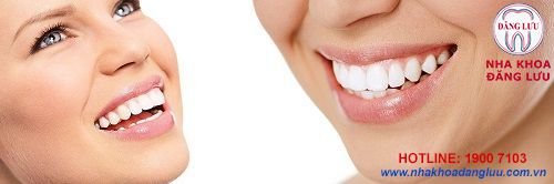 Những đặc điểm nổi bật của niềng răng invisalign