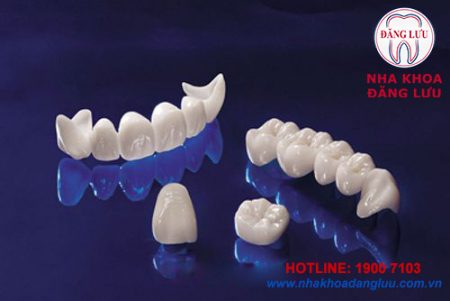 Phục hình thẩm mỹ với bọc răng sứ