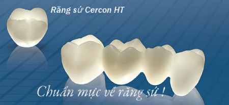Răng sứ Cercon có bền không ?