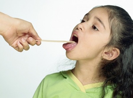 Một số bệnh răng miệng thường gặp ở trẻ