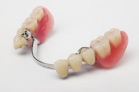 Chọn răng giả toàn hàm cho người cao tuổi 