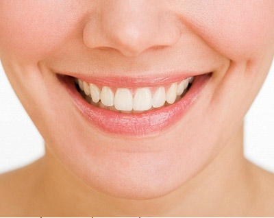 Niềng răng để nắn chỉnh hàm răng thẳng đều 