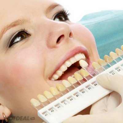 Quy trình tẩy trắng răng tại phòng khám nha khoa