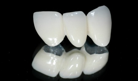  Răng sứ Zirconia có những ưu điểm nào ?
