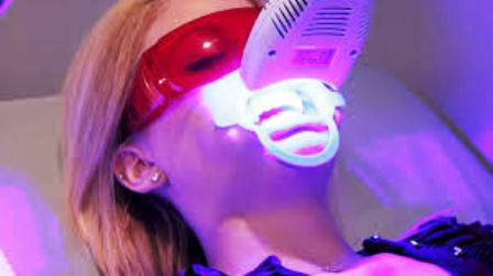 Tẩy trắng răng công nghệ mới