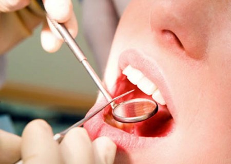 Quy trình cấy ghép implant hiệu quả cao