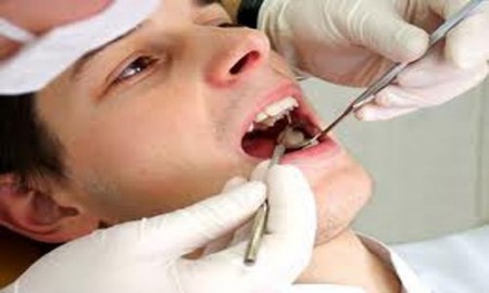 Làm gì sau khi cấy ghép implant