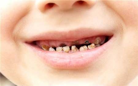 Các bệnh lý răng miệng thường gặp