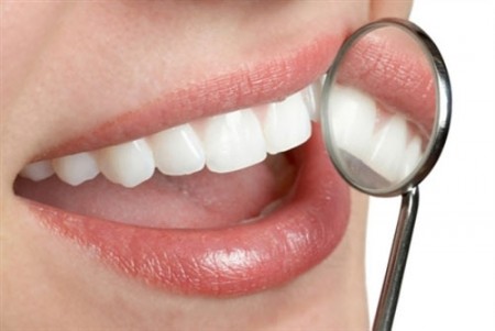 Bọc răng sứ bằng hệ thống Cerec