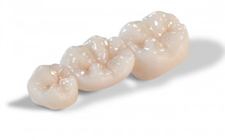 Răng sứ Zirconia có ưu điểm gì ?