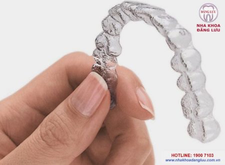 Niềng răng không mắc cài