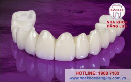 Răng sứ có niềng được không