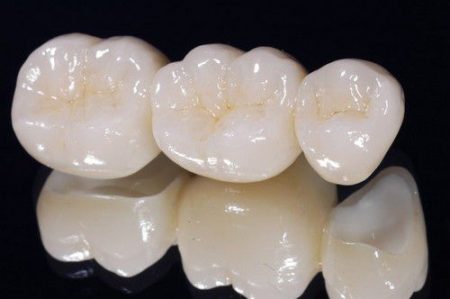 Răng sứ zirconia