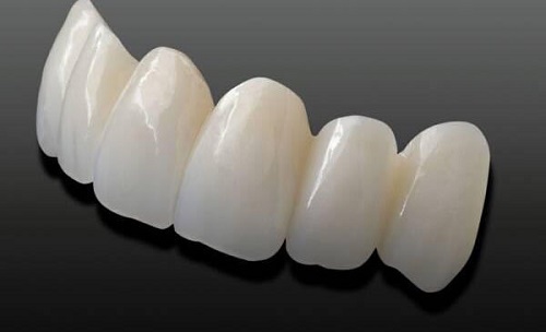 Răng toàn sứ Cercon 1
