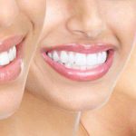 dịch vụ tẩy trắng răng tốt nhất tphcm