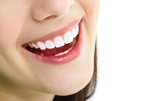 Làm sạch răng Implant như thế nào? 2