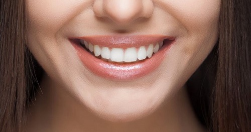 Niềng răng trong suốt có ưu điểm gì? 1