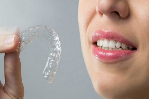 Phương pháp điều trị răng hô 3
