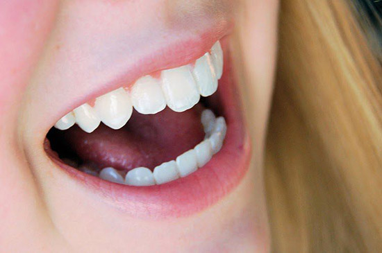 răng đã lấy tủy có nên bọc răng sứ