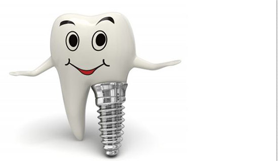 trồng răng implant có đau khôn