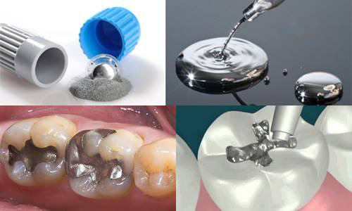 Vật liệu hàn răng thường dùng hiện nay 1