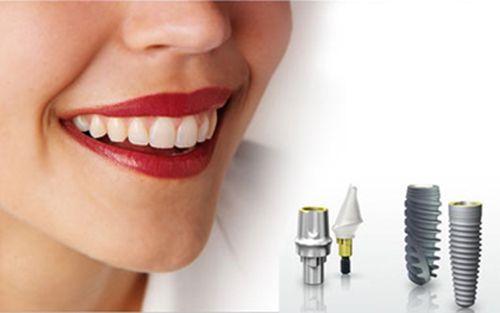 Cấy ghép implant ở trẻ em tốt không? 2