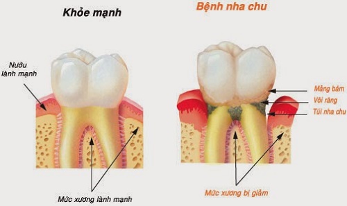 Có nên nhổ răng cho trẻ em không? 3