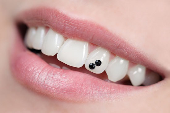 Dịch vụ bọc răng sứ thẩm mỹ tại trung tâm nha khoa