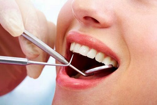 mẹo chữa viêm chân răng hiệu quả tại nhà