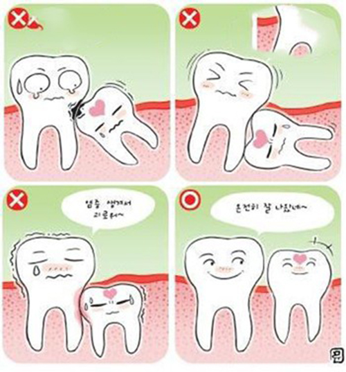 răng khôn mọc ngầm có nên nhổ không (