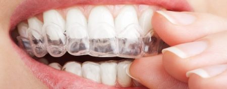 nieng-rang-3d-clear-3