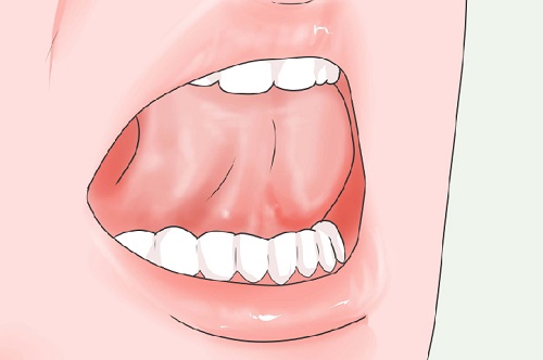 Chỉnh răng đều không cần niềng hiệu quả ra sao?