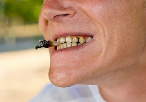 Làm răng sứ phải kiêng gì để đảm bảo kết quả lâu dài?