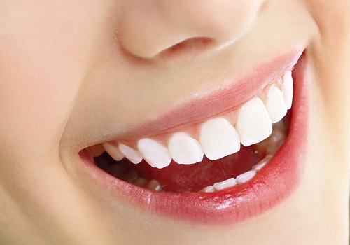 Những điều cần biết về răng sứ ceramill - Tìm hiểu ngay