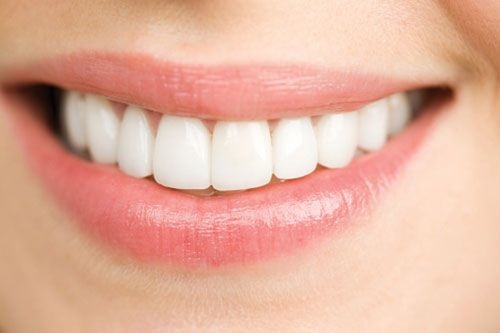 Răng sứ titan có mấy loại? Loại nào phổ biến nhất hiện nay