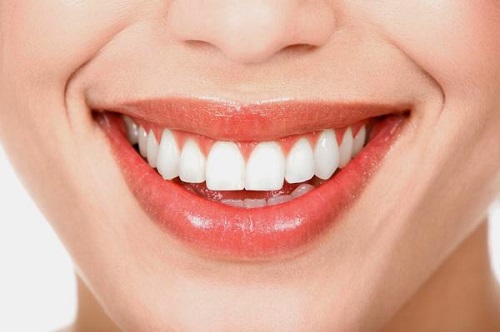 Răng thưa có niềng được không? Nha khoa tư vấn cách khắc phục hiệu quả