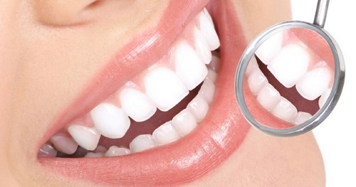 Tẩy trắng răng có ảnh hưởng gì không? Nha khoa tư vấn 2