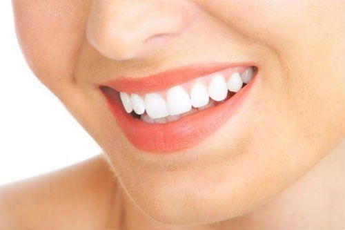 Tẩy trắng răng bằng đèn plasma có hại không? Xác minh từ nha khoa 1