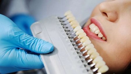 Bọc răng hàm bị sâu giá bao nhiêu? Có đắt không?
