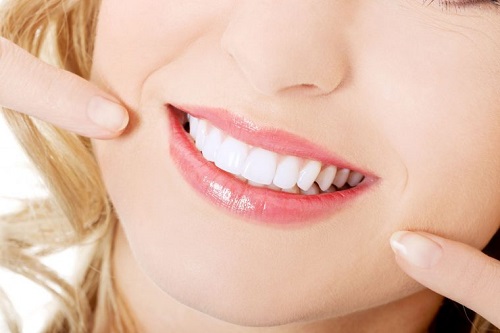 Bọc răng sứ không cần mài răng - Quy trình thực hiện