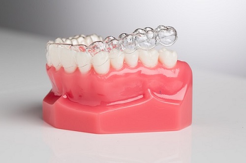 Dụng cụ niềng răng tại nhà có tốt không? Tham khảo	dụng cụ 2