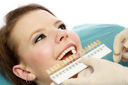 Tẩy trắng răng trong 1 tuần với cách làm nào? 3