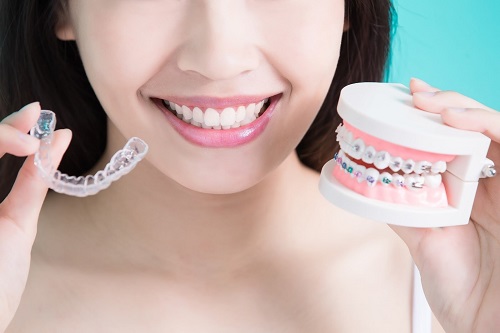 Niềng răng có nên dùng bàn chải điện? Nha khoa lý giải 2
