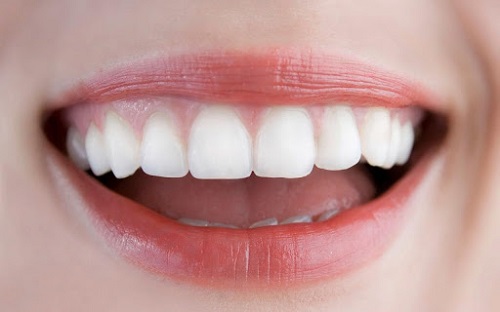 Bọc răng sứ zirconia - Tìm hiểu các thông tin liên quan 2