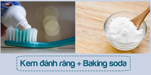 Tác hại làm trắng răng bằng baking soda bạn đã biết? 1