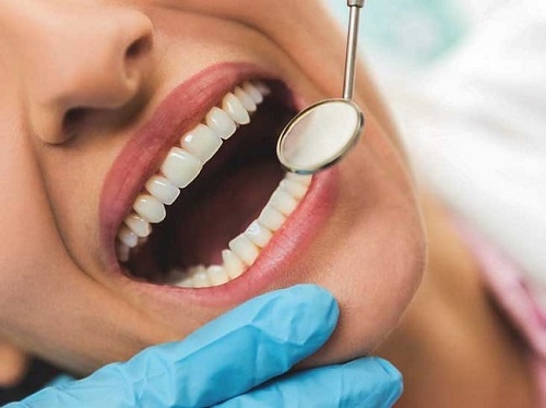 Bọc răng sứ cả hàm - Cần lưu ý điều gì? 2