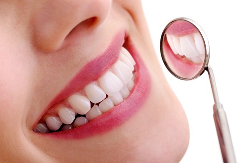 Răng sứ bị hở - Nguyên nhân và biến chứng bạn nên biết 2
