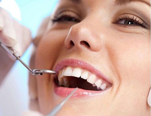Răng khôn hàm trên bị sâu phải làm sao? 3
